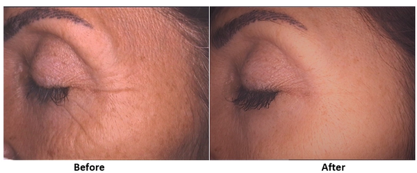 ChitoCare Hair, Skin & Nails